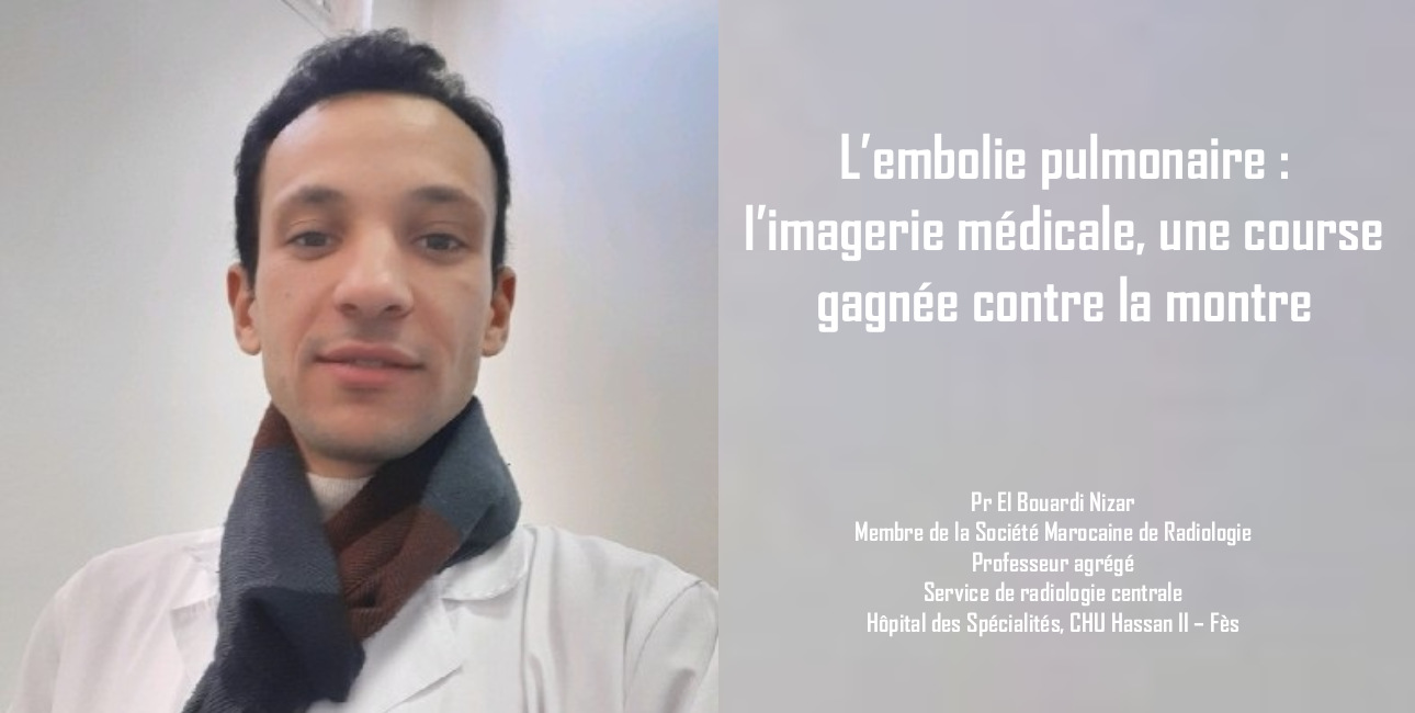 L’embolie pulmonaire : l’imagerie médicale, une course gagnée contre la montre