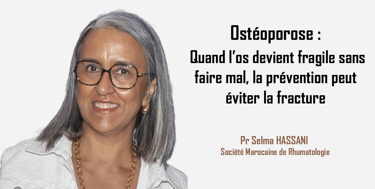 Ostéoporose: quand l’os devient fragile sans faire mal, la prévention peut éviter la fracture