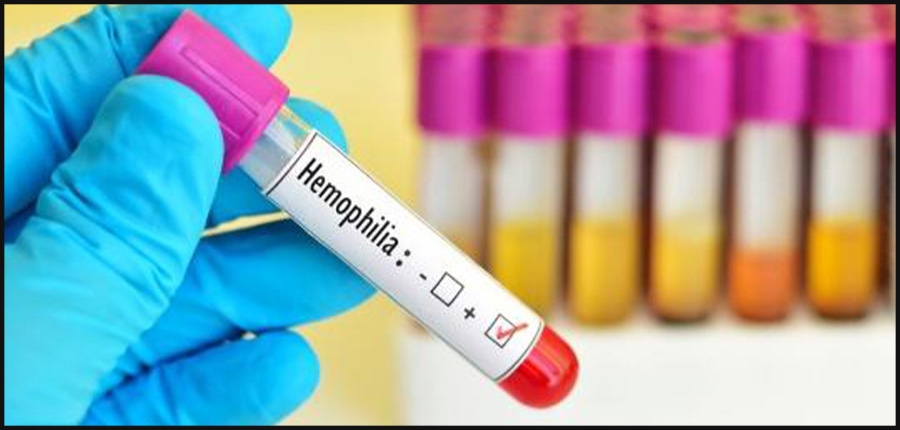 L’hémophilie n’est plus une maladie handicapante