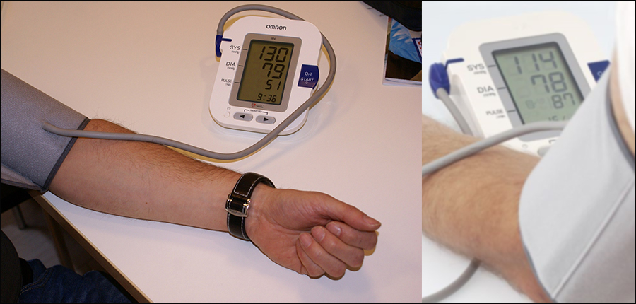 L’Hypertension artérielle (HTA) : Comment reconnaitre cette maladie silencieuse ?